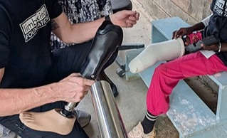 prosthetics